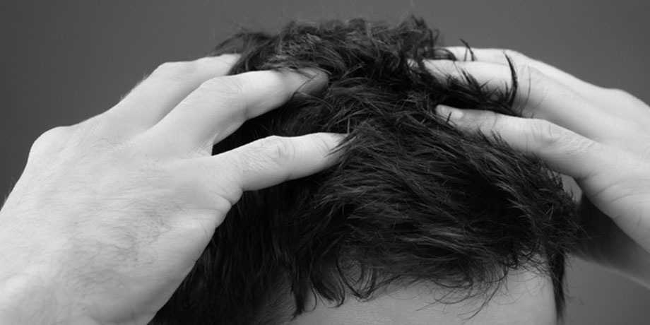 Perte de cheveux