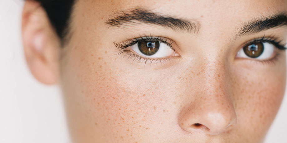 Tâche de pigmentation